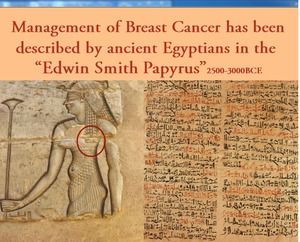 management-of-breast-cancer-has-been-described-by-ancient-egyptians-in-the-edwin-smith-papyrus